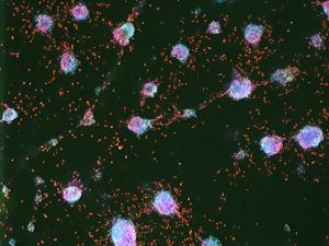 Stem Cells Creating Insulin Producing Cells