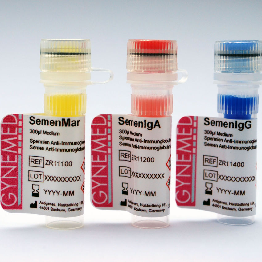 Anti-sperm antibodies detection