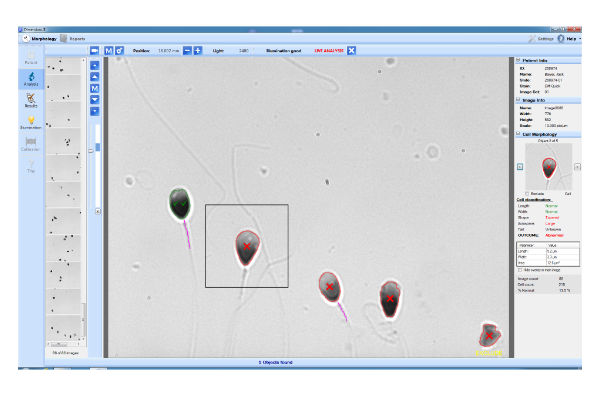 Dimensions II Software for the IVOS II and CEROS II Systems