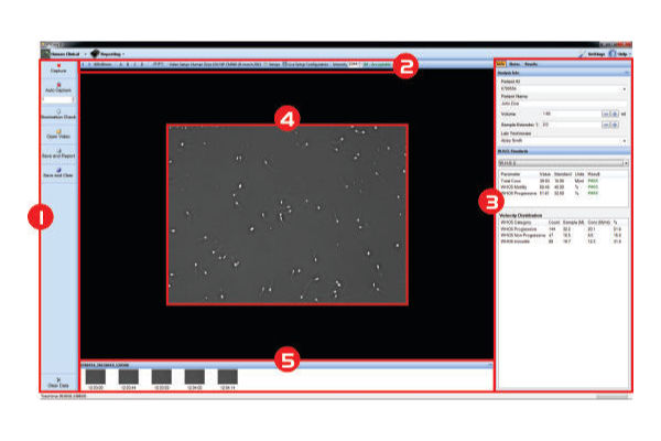 Human Motility II Software