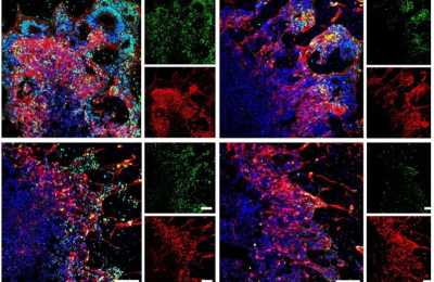 Frozen Human Brain Tissue can now be Revived Without Damage
