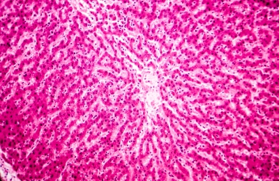 Cryopreservation of hepatocyte microbeads for clinical transplantation