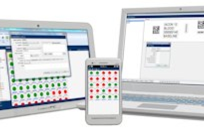 Sample tracking - Are you leaving too much to risk?