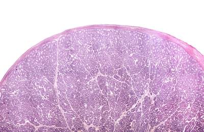 Optimising Cryopreservation of Human Testicular Tissues
